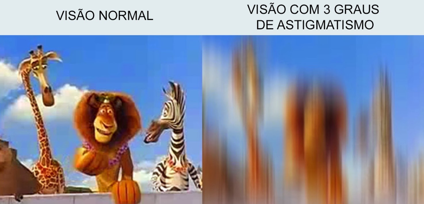 Astigmatismo O Que Tem Cura Como Cuidar