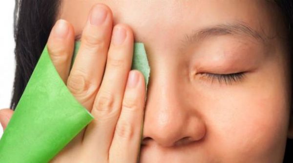 Terçol no Olho : o que? por que ocorre? como evitar e cuidar?