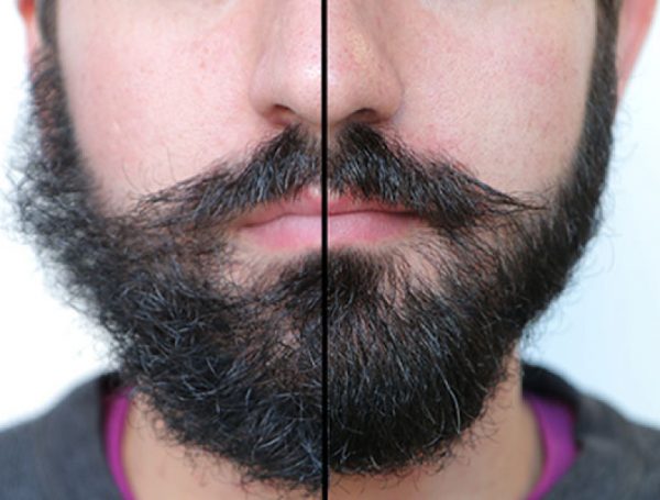antes e depois - óleo para barbear