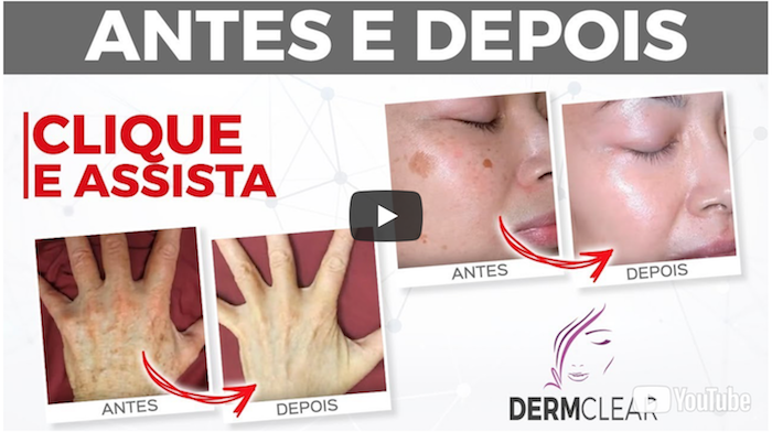 dermclear antes depois