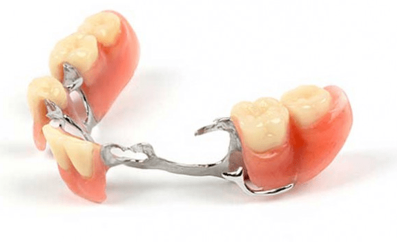 protese dentaria parcial removivel