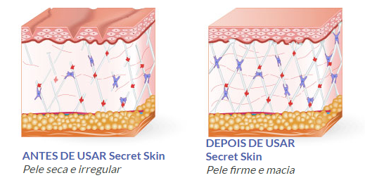 secret skin antes e depois
